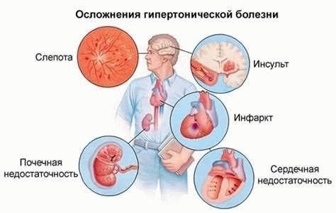 Какие дополнительные исследования проводятся при наличии гипертонии?